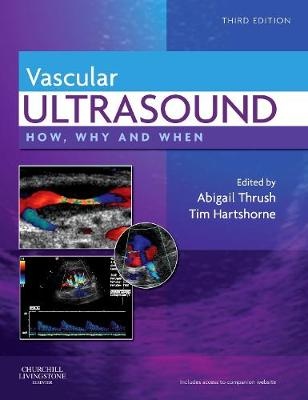 Vascular Ultrasound : How, Why and When