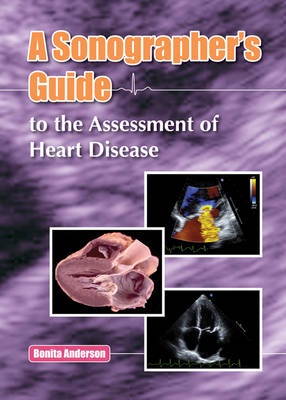 A Sonographers Guide to the Assessment of Heart Disease